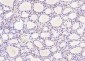 UBE2V1 Polyclonal Antibody